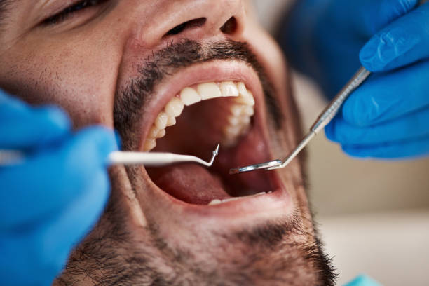 Professional Emergency Dentist in NJ